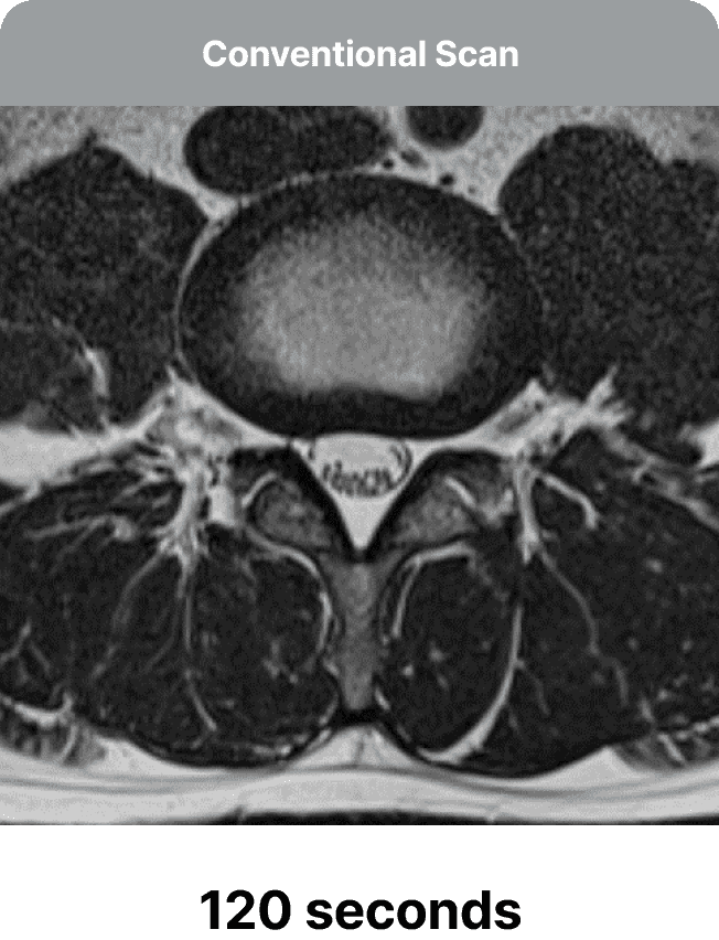 Conventional MRI scan at 120 seconds